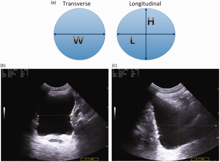 Figure 11