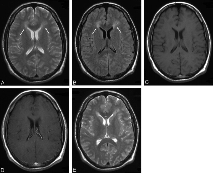 Fig 6.