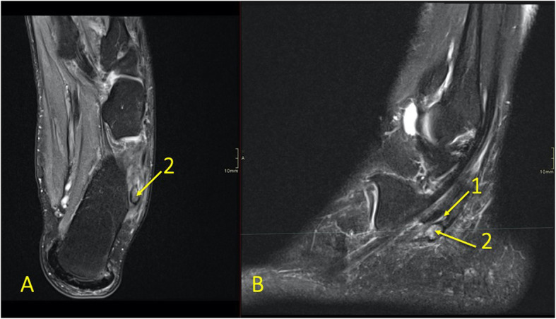 Fig. 22