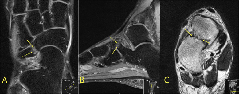 Fig. 24