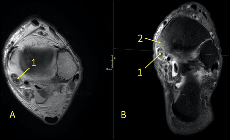 Fig. 8