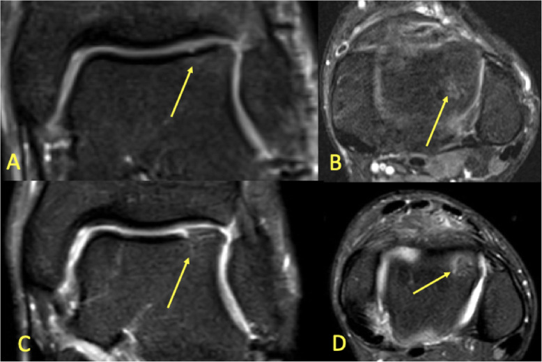 Fig. 17