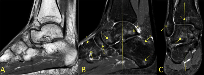 Fig. 32