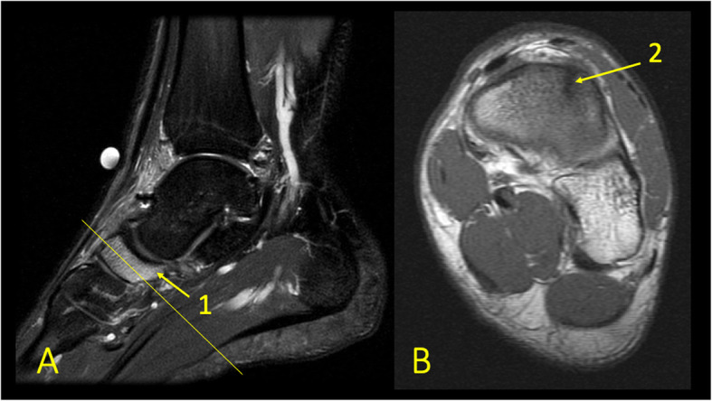 Fig. 14