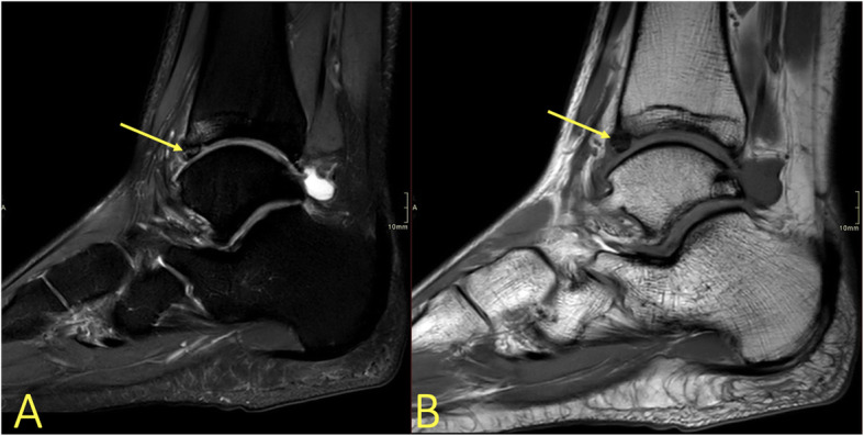 Fig. 20