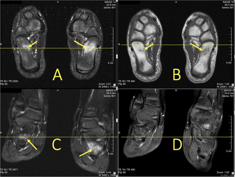 Fig. 33