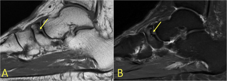 Fig. 15