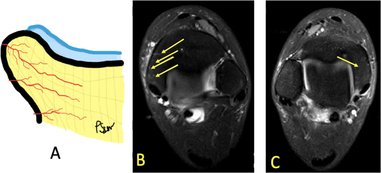 Fig. 25