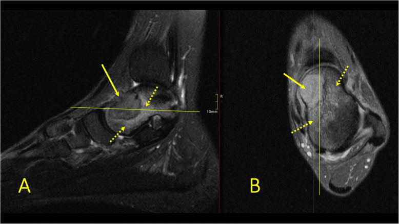 Fig. 30