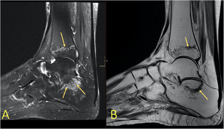 Fig. 13