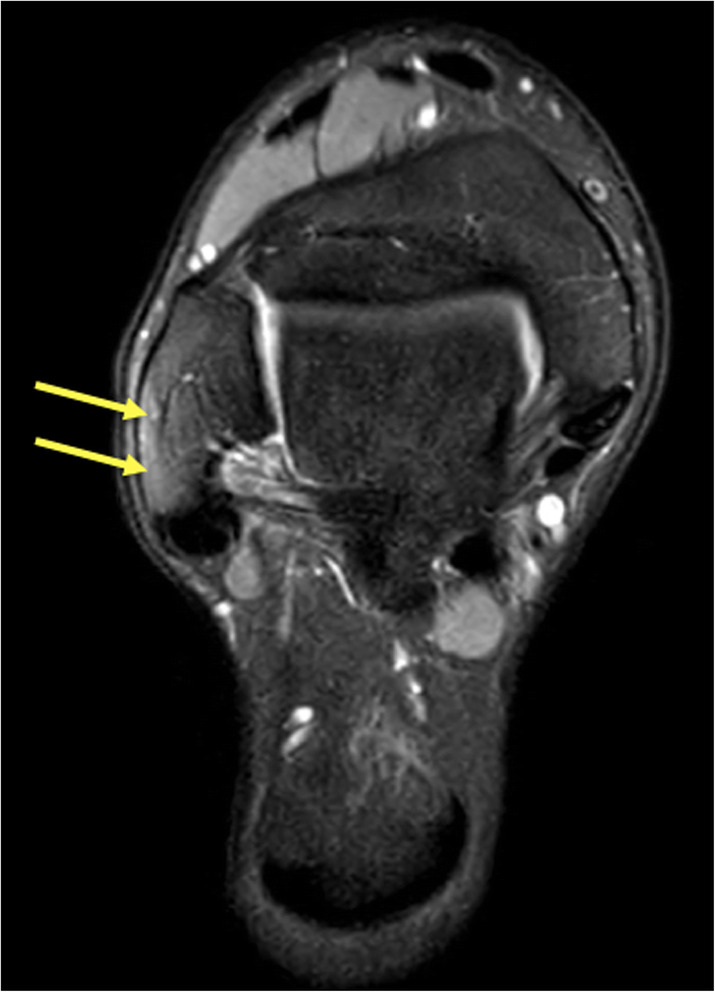 Fig. 35