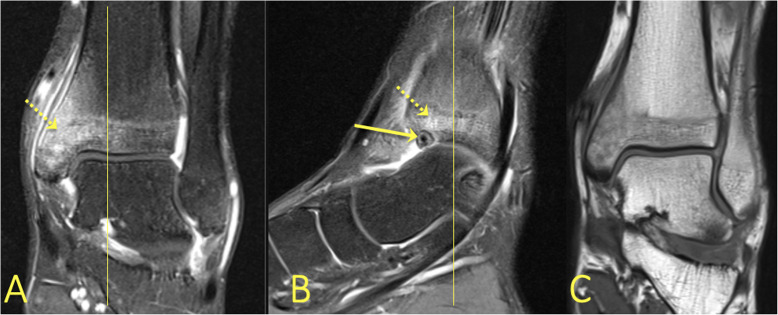 Fig. 31