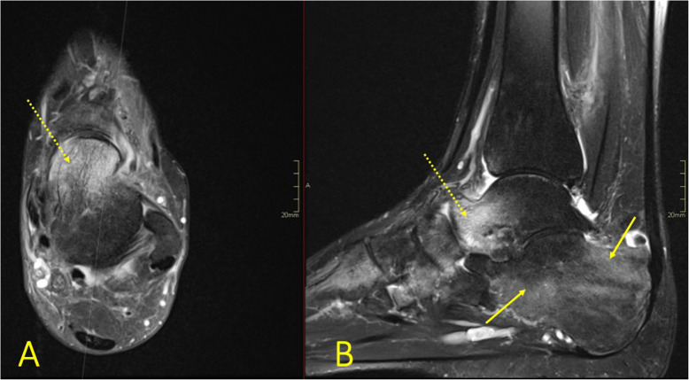 Fig. 28