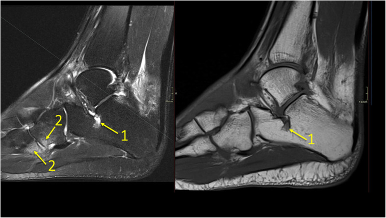 Fig. 34