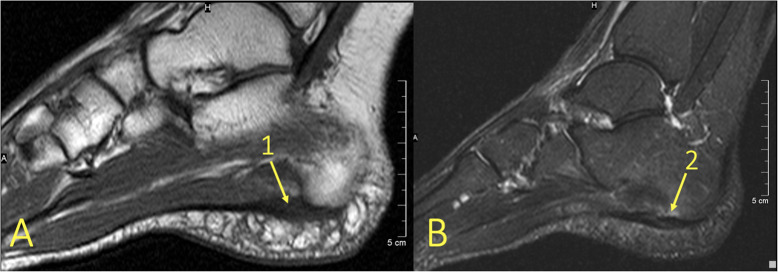 Fig. 12