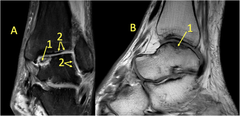 Fig. 18