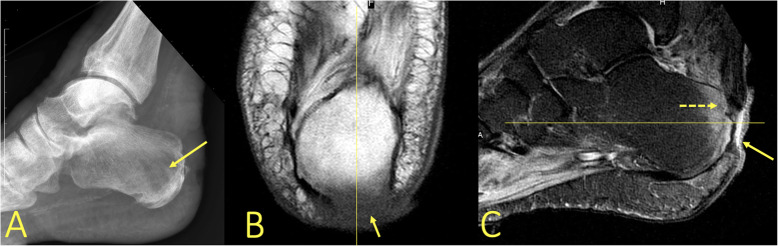 Fig. 27