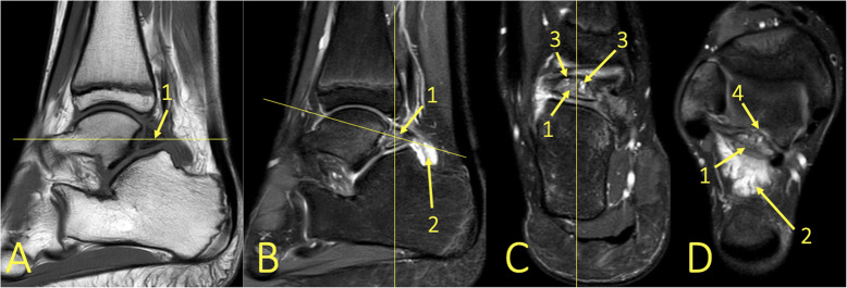 Fig. 21