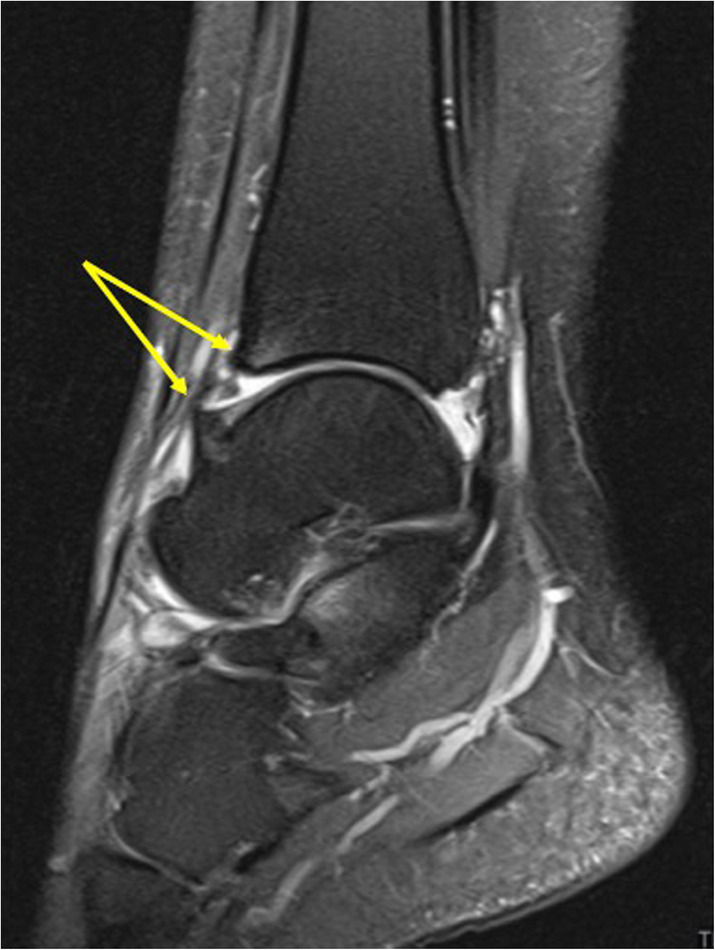 Fig. 19