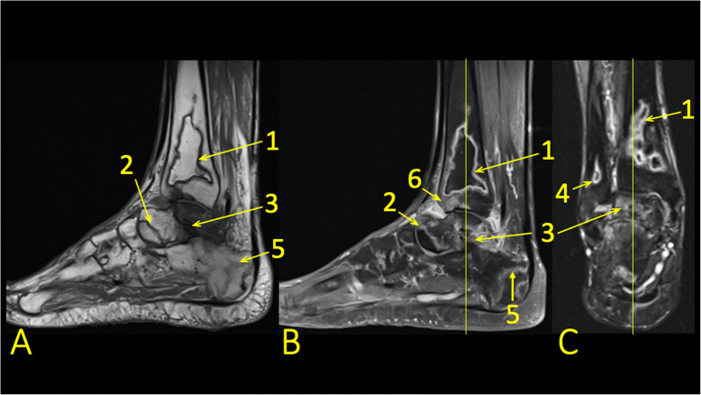 Fig. 16