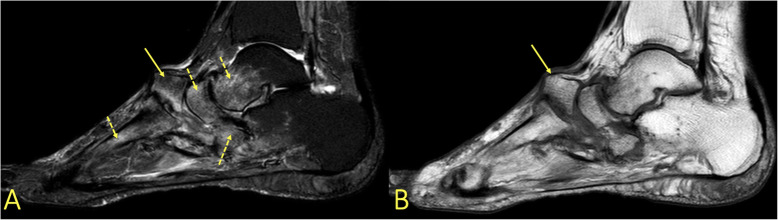 Fig. 29