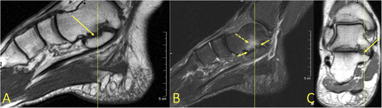 Fig. 23