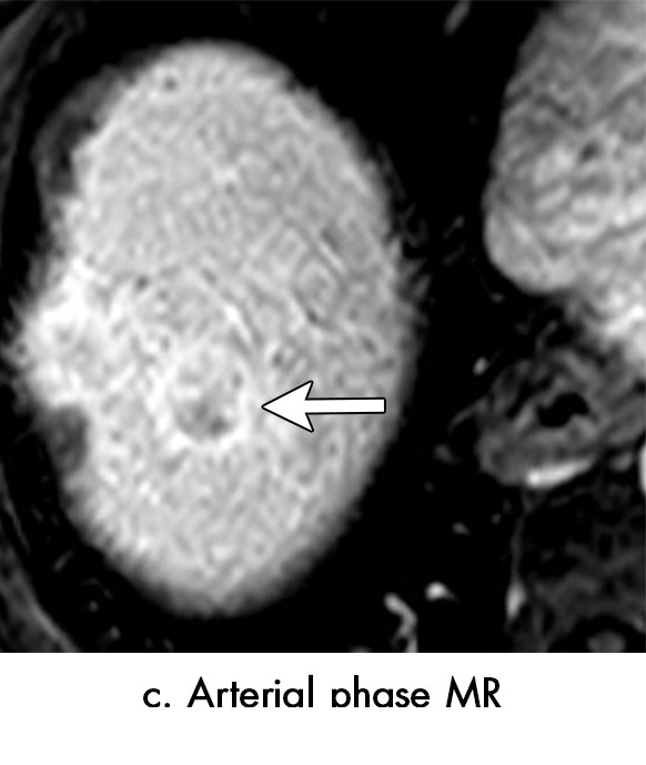 Figure 9c: