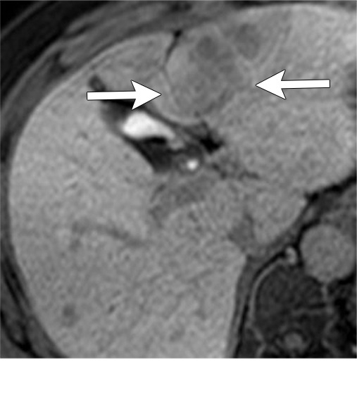 Figure 8b: