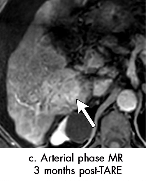 Figure 6c: