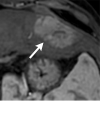 Figure 7g: