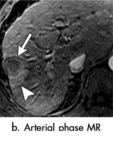 Figure 3b: