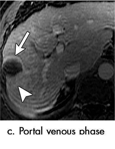 Figure 3c: