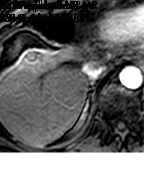 Figure 11e: