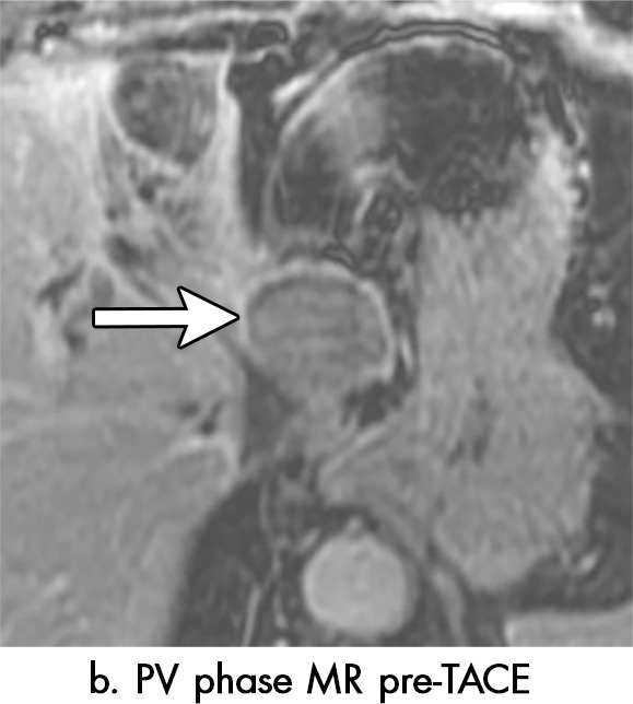 Figure 5b: