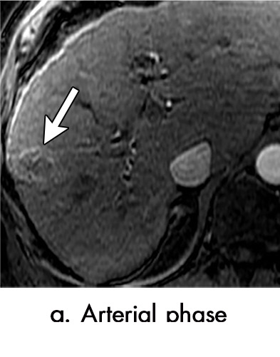 Figure 3a: