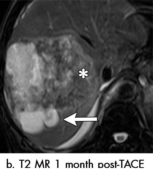 Figure 4b: