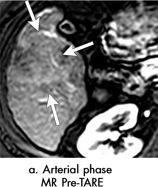 Figure 7a: