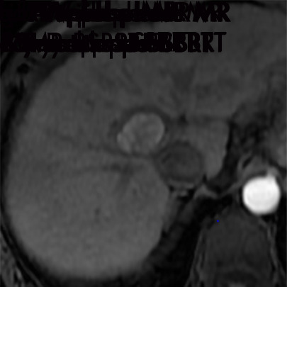 Figure 10a: