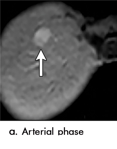 Figure 2a: