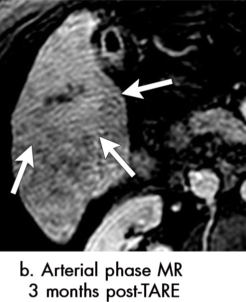 Figure 7b: