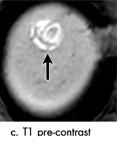 Figure 2c: