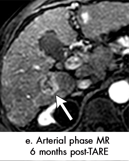 Figure 6e: