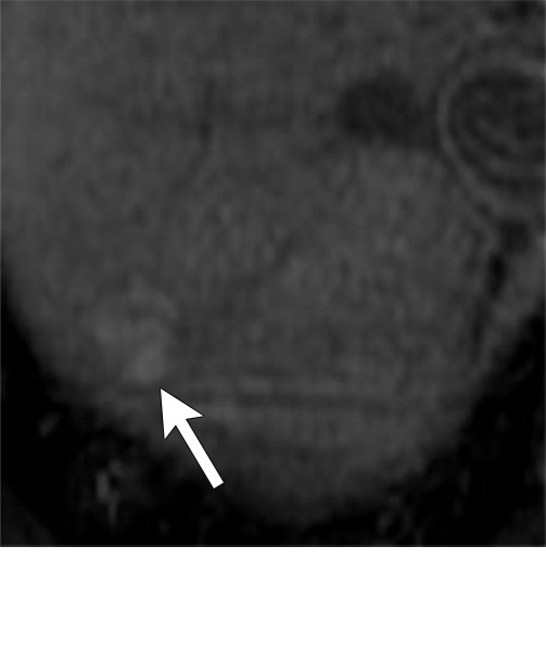 Figure 7e: