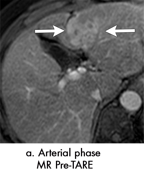 Figure 8a: