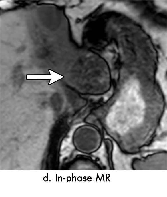 Figure 5d: