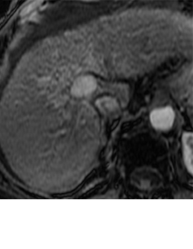 Figure 10c: