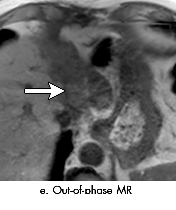 Figure 5e: