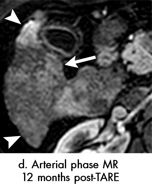 Figure 7d: