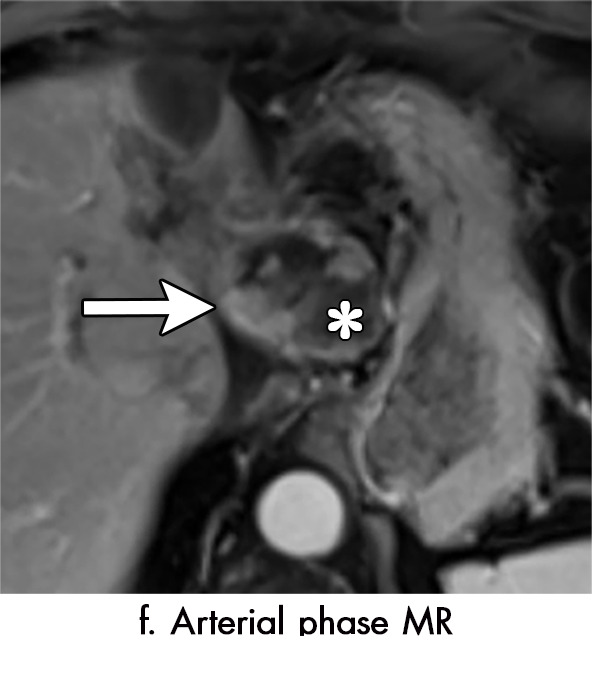 Figure 5f: