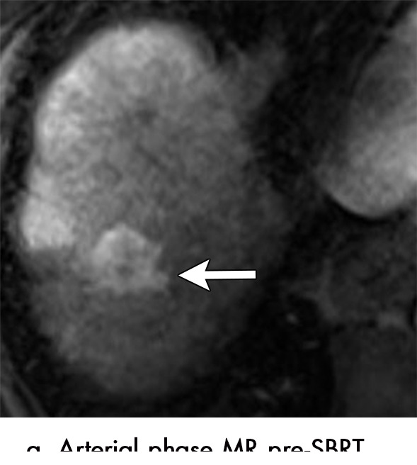 Figure 9a: